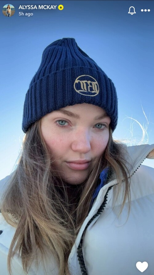 100000392506903688229abd82