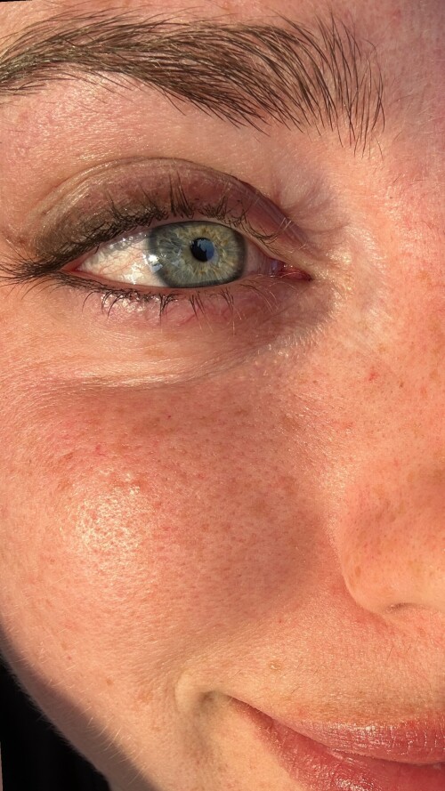 10000682795f23c19fe72e34f5