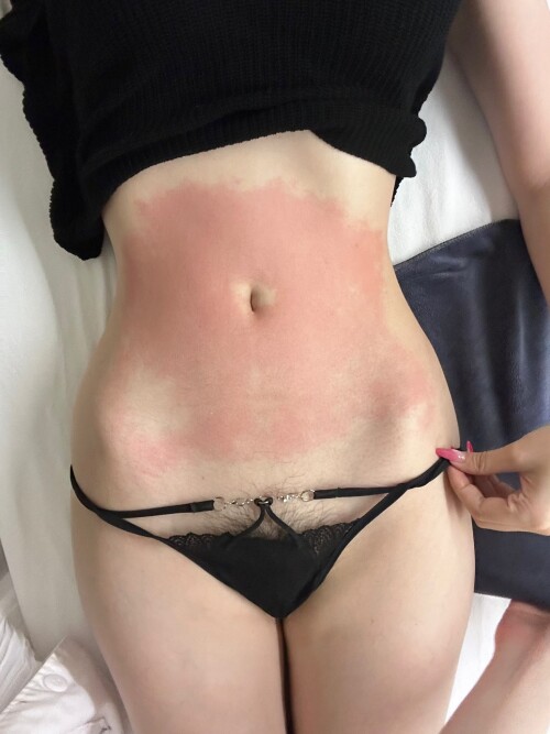 1000080304c594abd2abdc095f