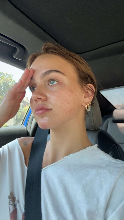 1000083223cf6d9a386bb17ad9