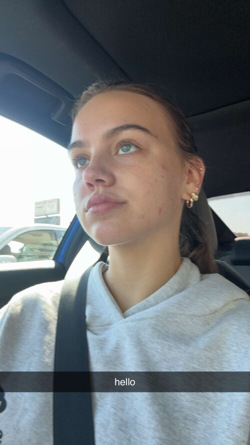 10001049706b2ea0292feee17d