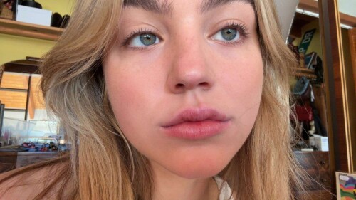 100035577409eb652a235a332a