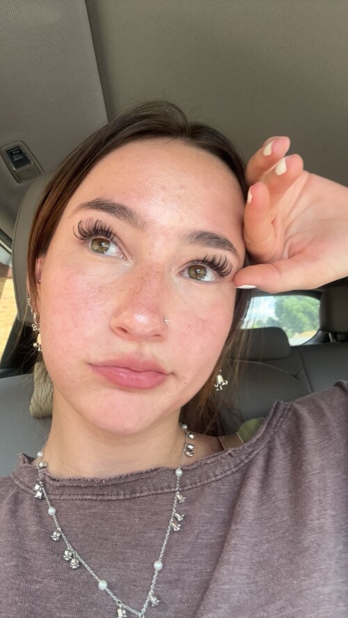 171499fa175b7f0a6f496