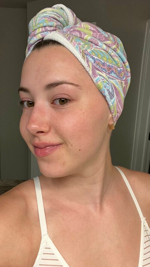 2023 08 23 pineapplebrat 10dcdbe224e43b2459