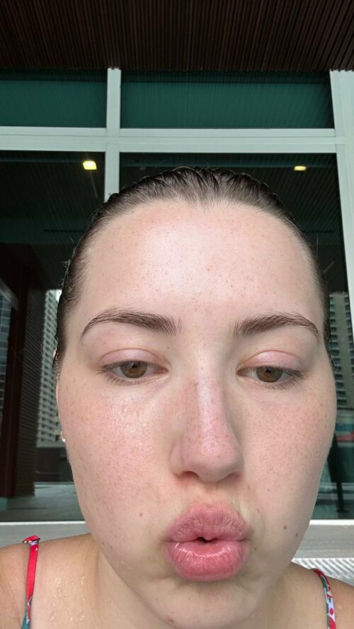 2023 09 07 pineapplebrat 35631f95e21a6e18c6