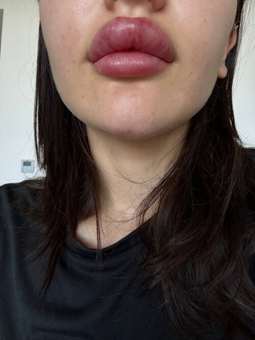 52853758242220821146e1f0f00b7216238