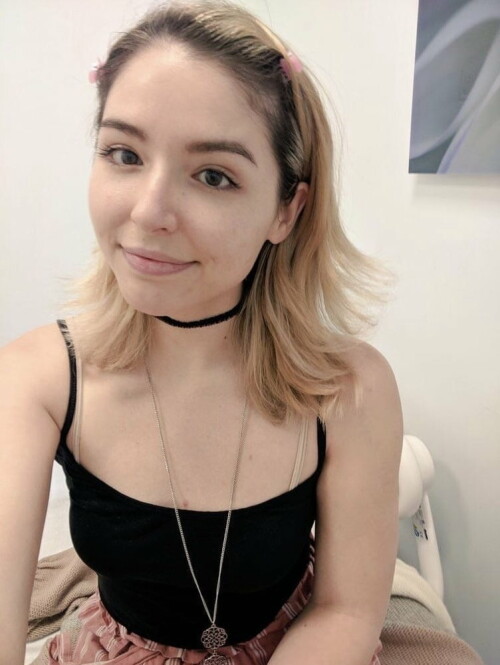 918 1000dcfbca2fb7077c79