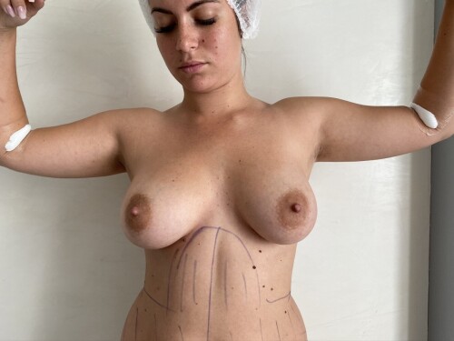 CM 1dacf165d4a603575