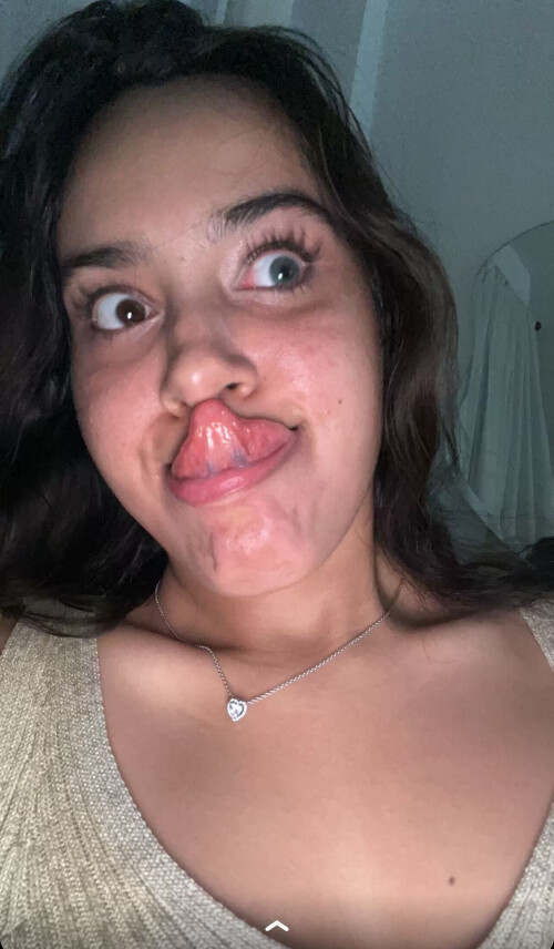 IMG 174187d2c51883a6ed19