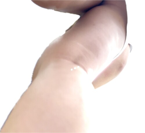 IMG 23461ad41557f54162f4