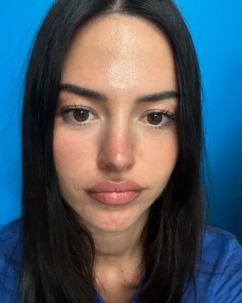 IMG 2497fd075ad6911a0a6b