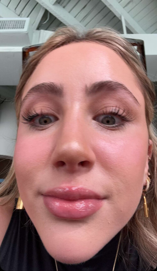 IMG 3141289415a92722d5c5