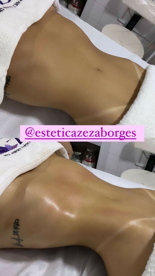 IMG 42019eb4172ff8bbb9b3