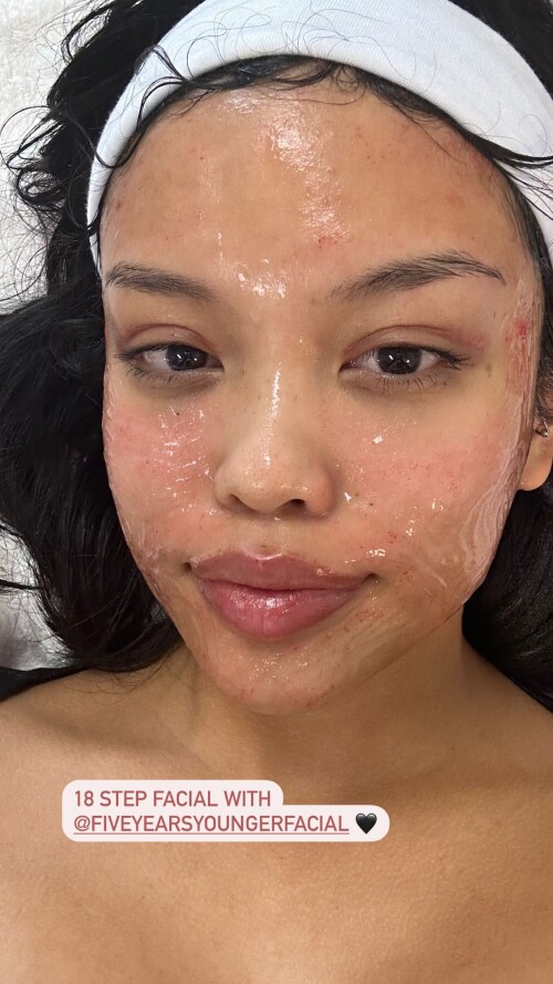 IMG 61729036e29000b82211