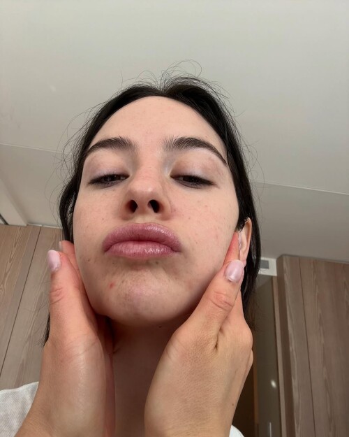 IMG 81157486d8678239448b