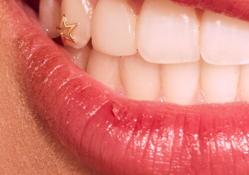 IMG 9397995cfd57c1f80327