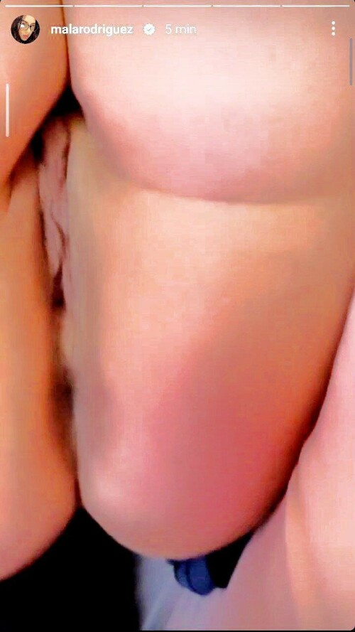 MR 87499c5d6b95d076f3d