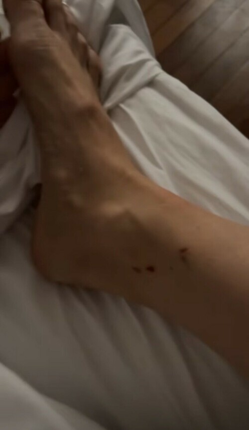 MR 9416b6dbdd84ec341c2