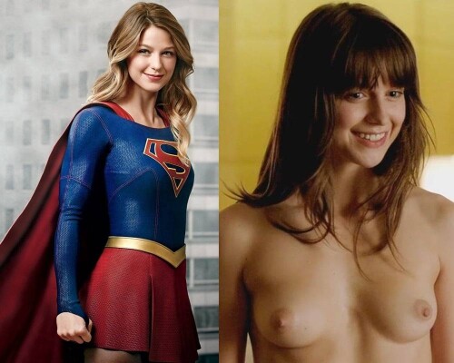Melissa Benoist R037974bd5b29881a9ff