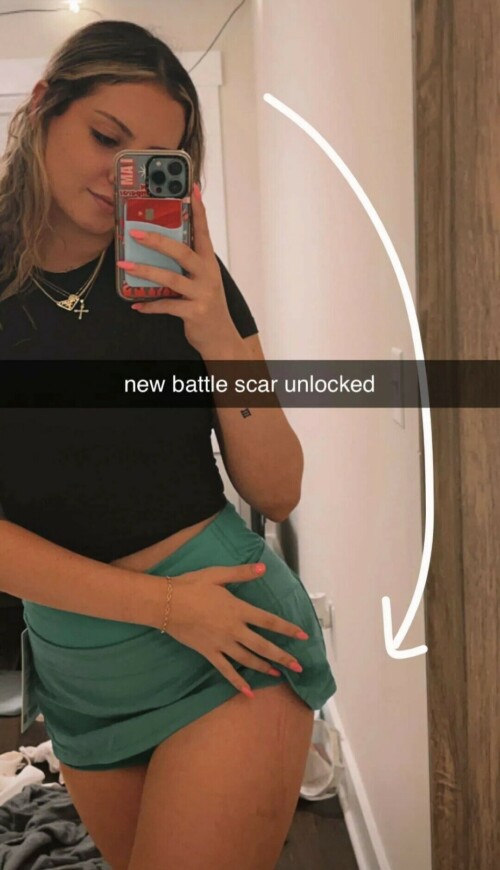 Screenshot 20230808 205000 Snapchatfeb20dbc575a3139