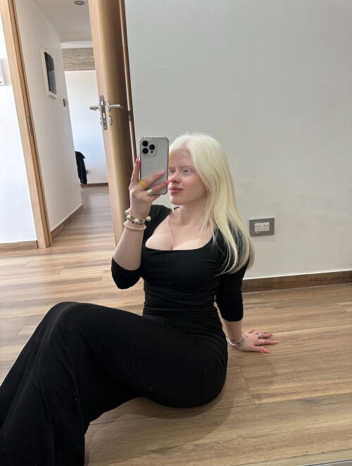 You dont know me albino trend 44936f604453ebeba