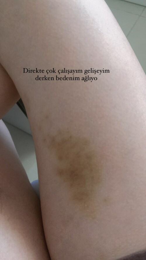 aldreann 3171371263471983165dd66d13c8132f5a2