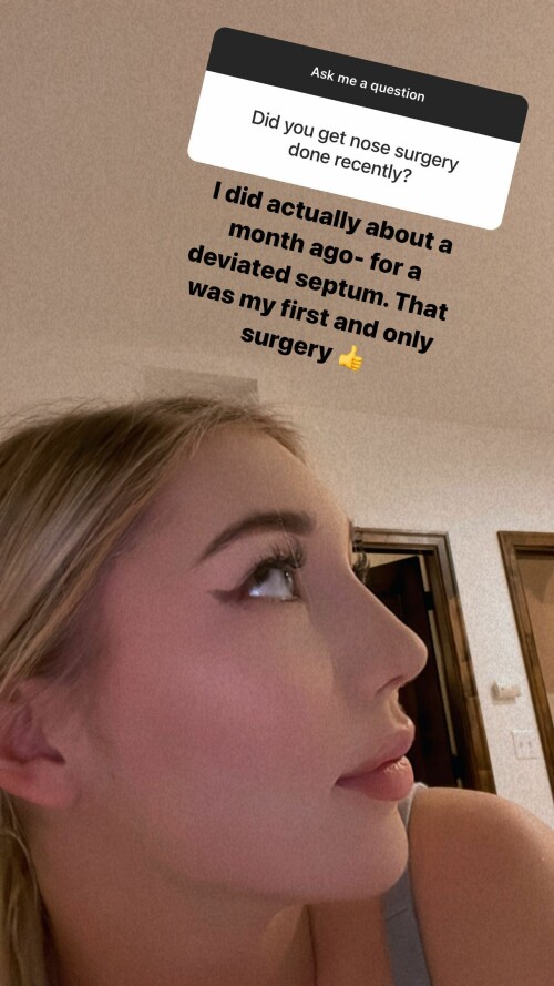 brooke.michelleee CY aJK lp4p