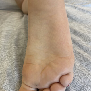 fio012ATK_392761182ae25f03274115787