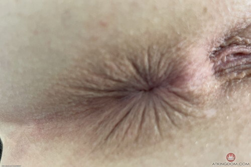 fio012atk 3931381592a3f2058d94df5d70491d675c75440f9