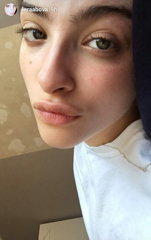 ig 17ac5add090e4d45ae