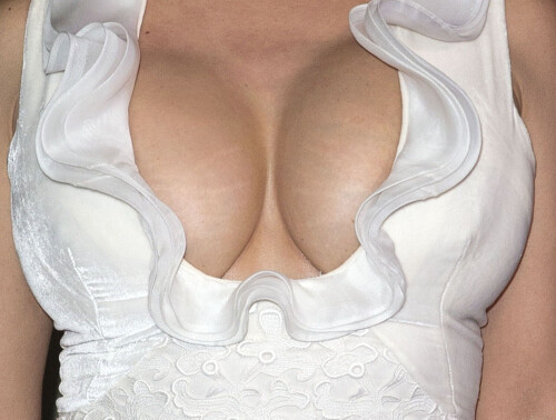 img 0035834efbf826fd13bab