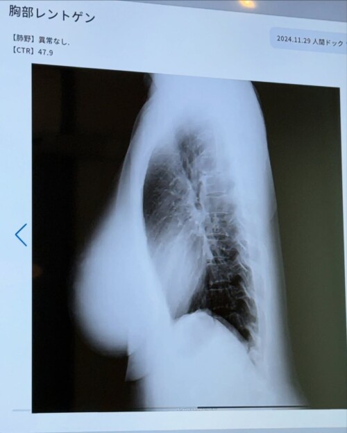 jun.amaki-02-02-2025-000489646edf69815b58