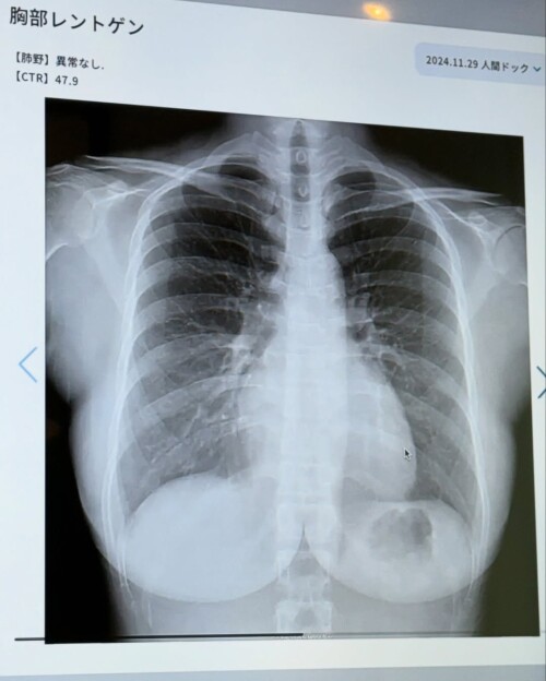 jun.amaki-02-02-2025-0005ee531155e19be470