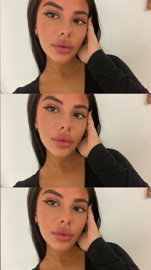 lou mrcsl 1678718926547