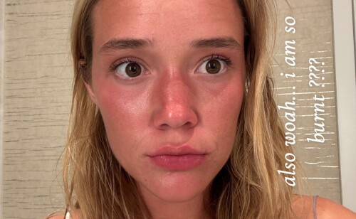 ssnaps A3D47BF7F8D04AD92DF7E9BF47509FB594fb16c11c46e84c