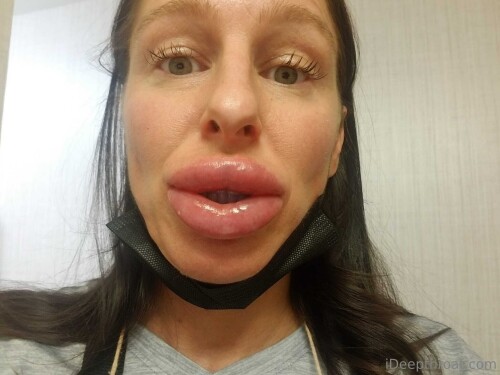 untitled 8fba2c2f8704865ce