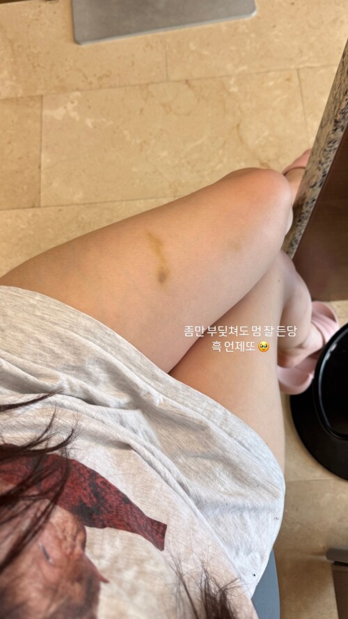 xxapplee kr 20250410 STORIES 3607657752094526642 5 360826401973665523364edc2698059c995